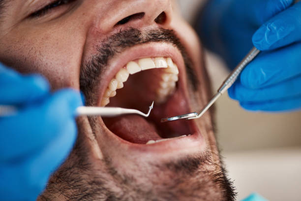 Best Tooth Pain Emergency Relief  in Bridgman, MI